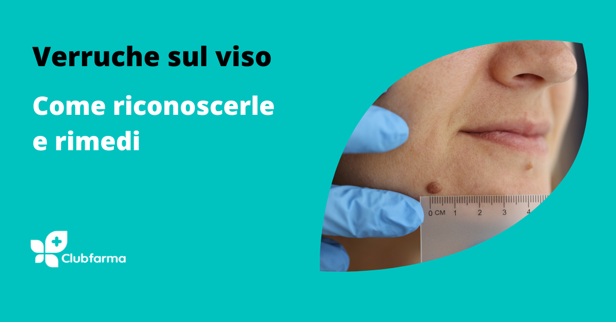 Verruche sulla pelle del viso: cosa sono, come riconoscerle e rimedi