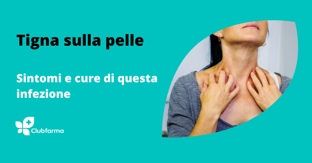 Tigna sulla pelle: sintomi e cura di questa infezione fungina