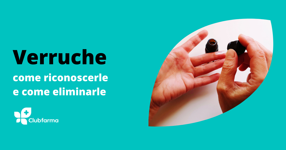 Verruche: come riconoscerle e come eliminarle